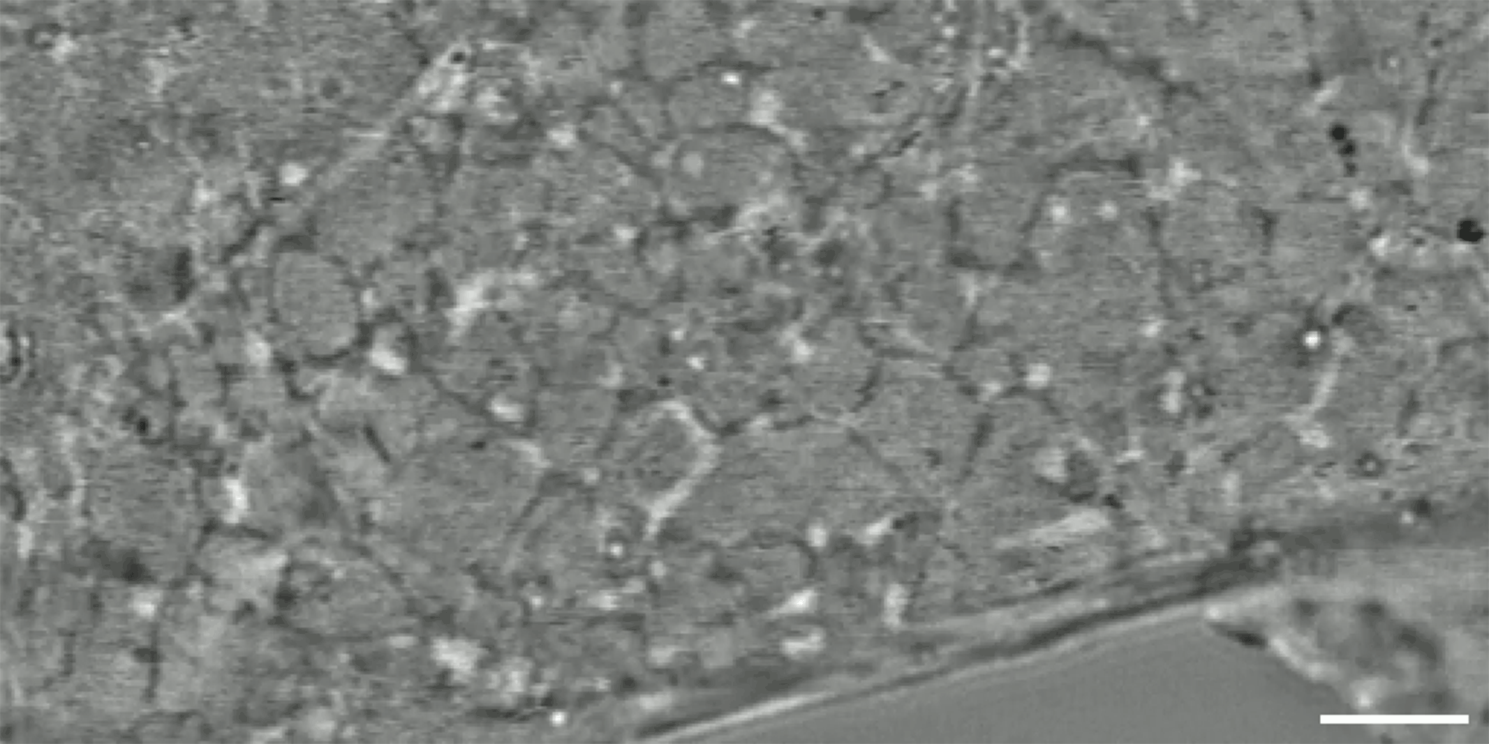 The new iISM microscope allows researchers to see incredible detail inside a live cell without the use of fluorescent labels. This video shows the wiggling tubules of the endoplasmic reticulum and moving vesicles as well as many other processes.