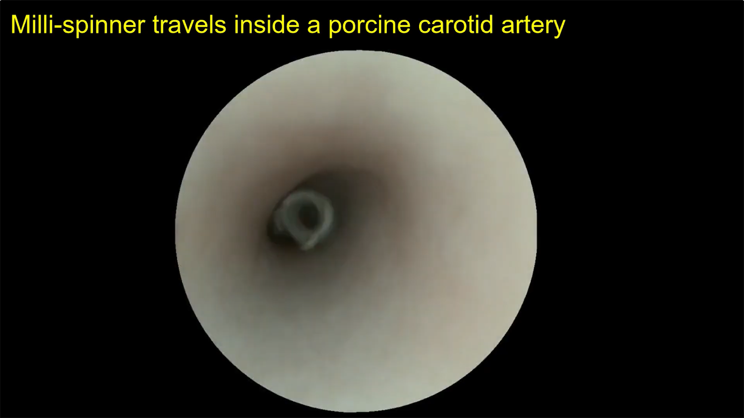 Endoscopic view inside a pig carotid artery with a small spinner device at the center.