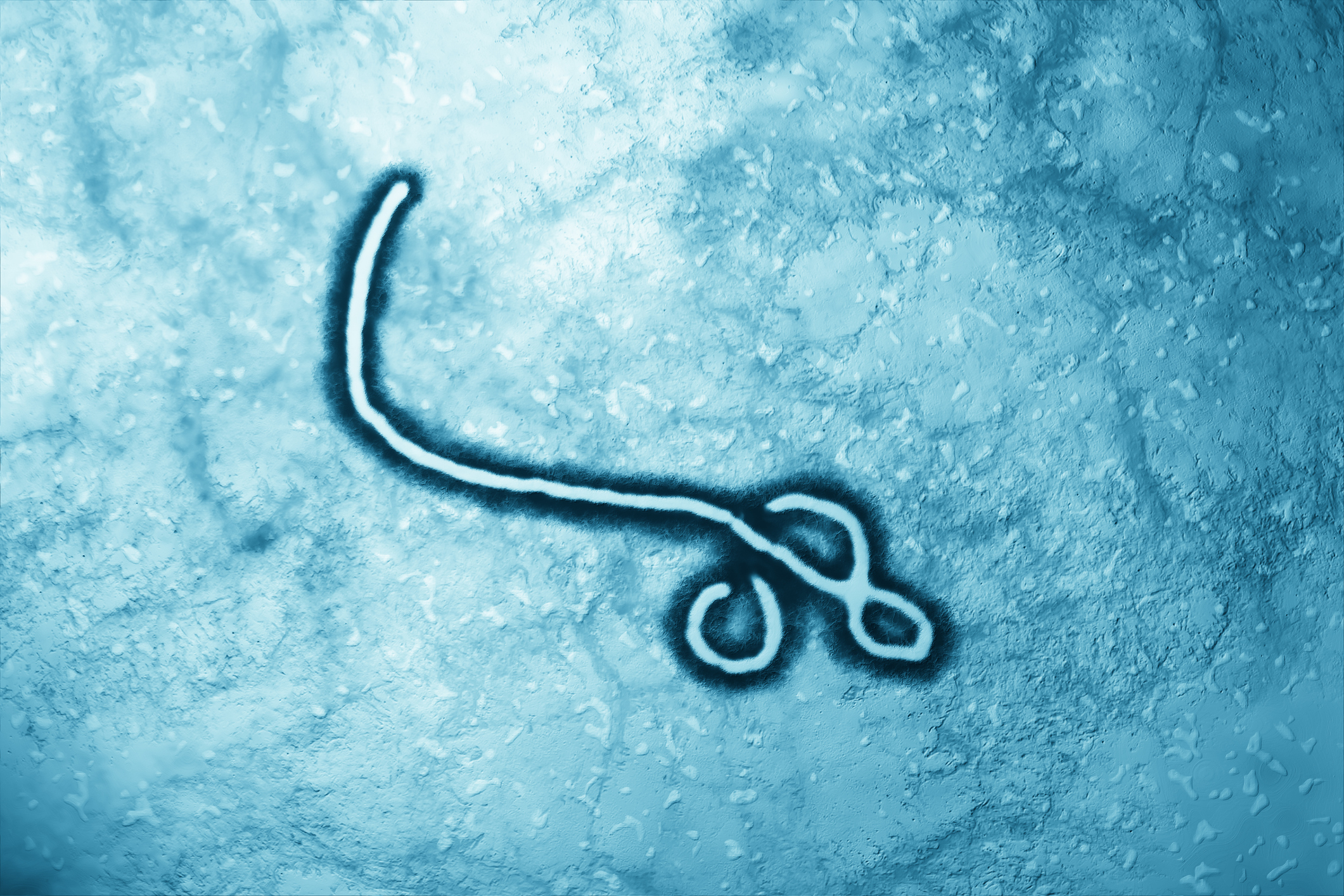 Colorized electron micrograph of the Ebola virus, shown as a curved, thread-like filament with looped ends, against a blue textured background.