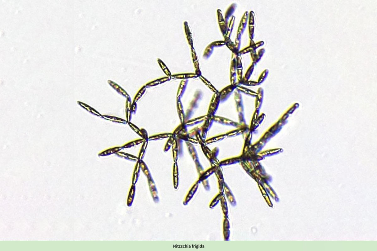 Microscopic image shows the diatom Nitzschia frigida, a chain-forming species found in polar ice.
