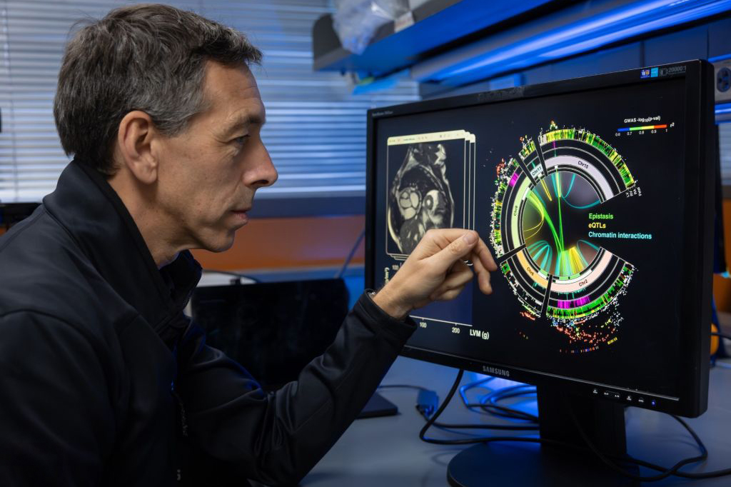 Euan Ashley interacts with a computer screen displaying complex genetic data and cardiac MRI scans related to heart mass analysis.