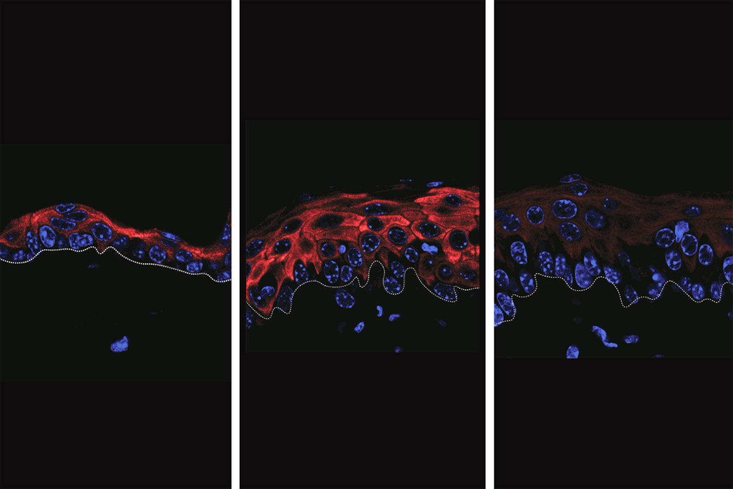 Three-panel microscopic view showing red and blue stained cells, highlighting cellular structures.