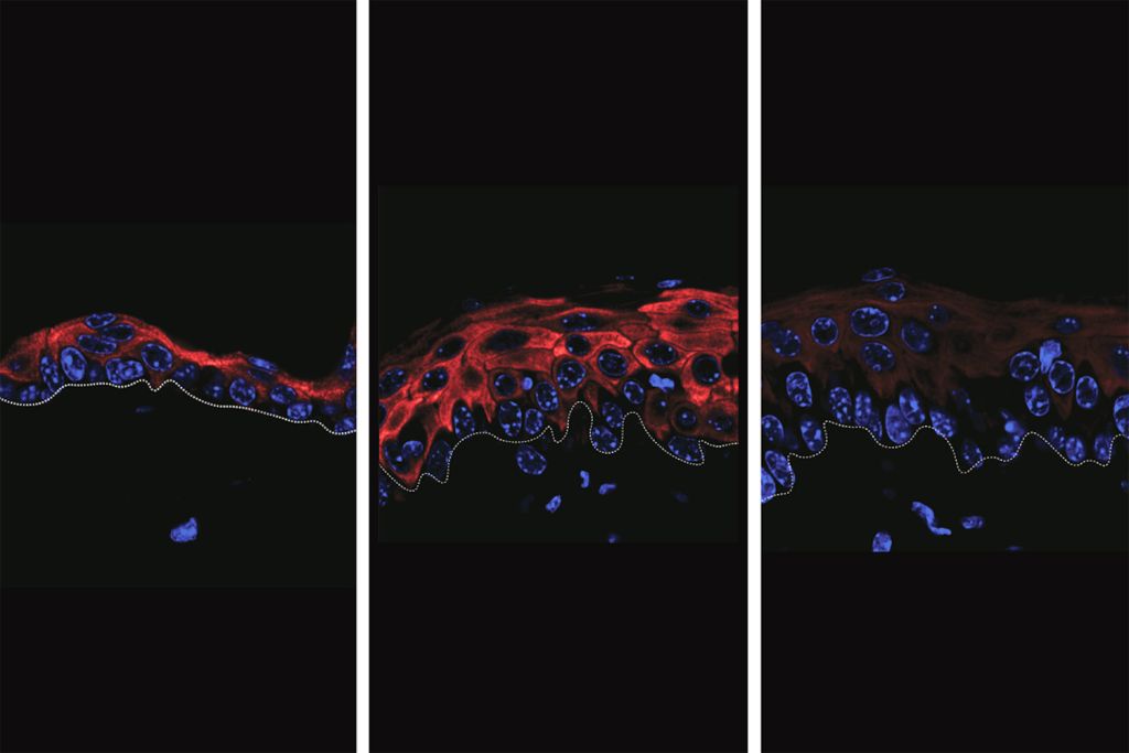 Three-panel microscopic view showing red and blue stained cells, highlighting cellular structures.