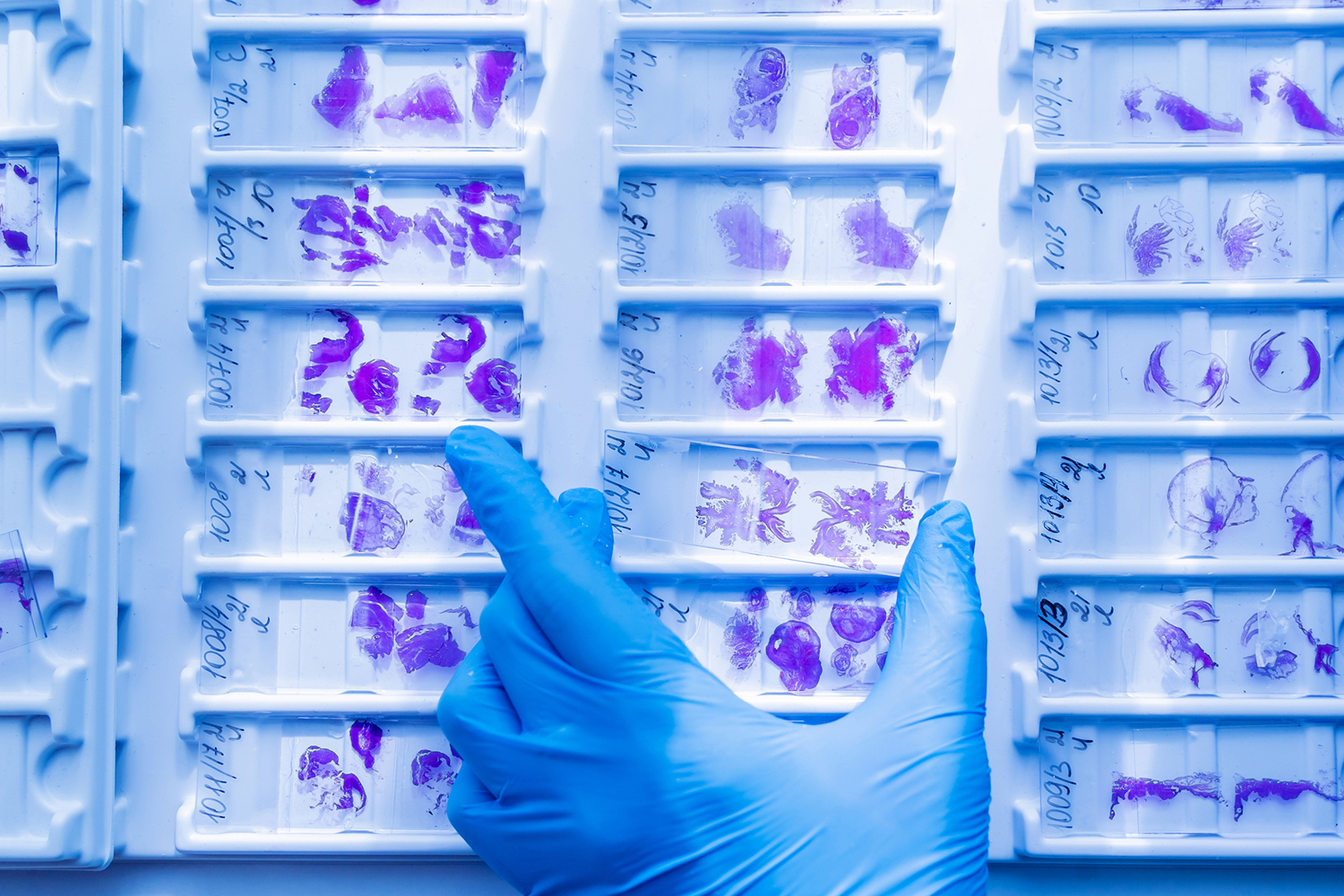 A gloved hand points at microscope slides displaying purple-stained cellular samples in organized trays.