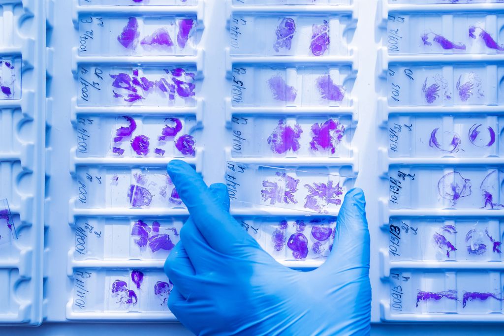 A gloved hand points at microscope slides displaying purple-stained cellular samples in organized trays.