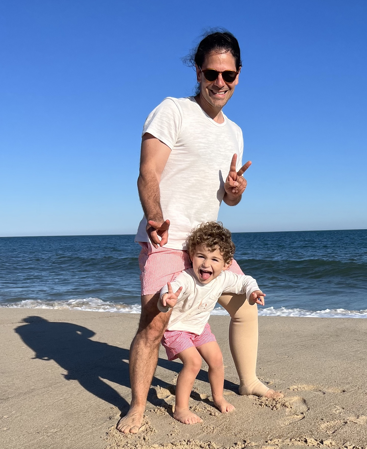 Matthew Holbreich, wearing a a compression stocking for his lymphedema on his left leg, poses for a photo with his child on a sunny beach with the ocean in the background.