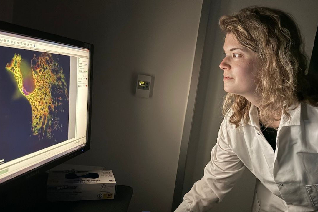 Researchers views fluorescently tagged ribosomes.