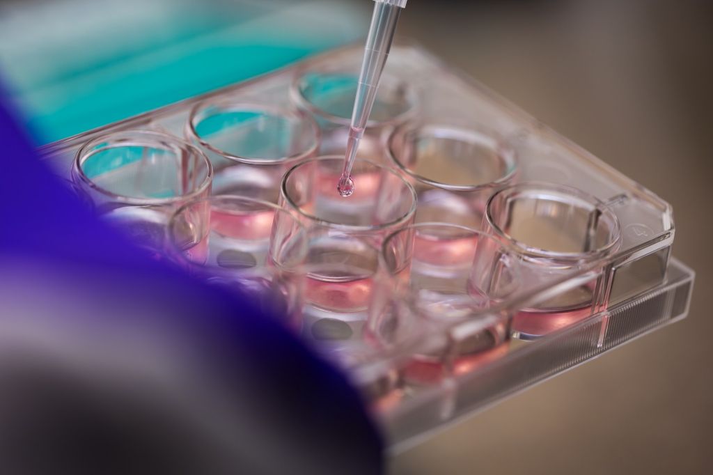 A close-up of a lab technician using a pipette to add liquid to wells in a culture plate for growing heart muscle cells.