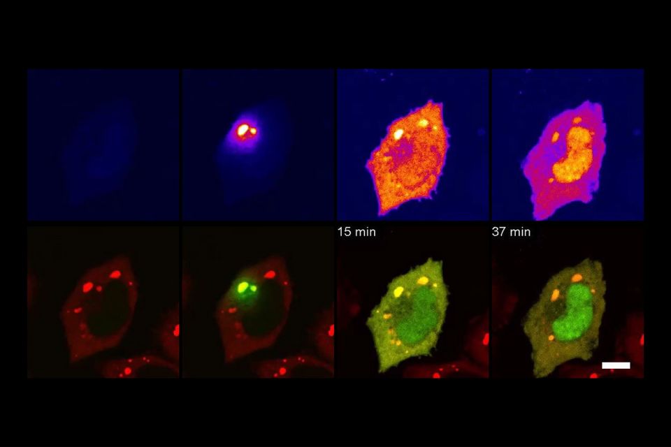 Tracking protein traffic in living cells | Stanford Report