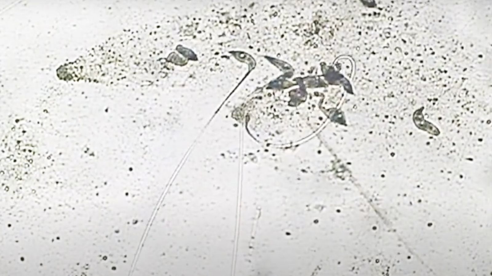 Microscope image of Lacrymaria olor with extended shapes
