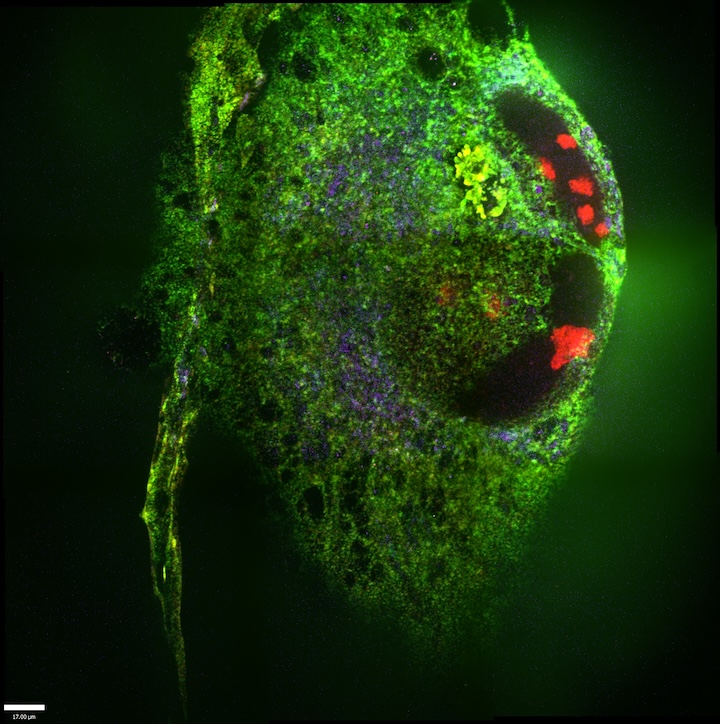 In this RiboExM image of a cell with two nuclei (which may mean this cell was dividing), small subunits of the ribosome are in red, which can be seen in clusters within the nucleus. The green indicates the large subunit of the ribosome, and the purple is a label for mitochondria.