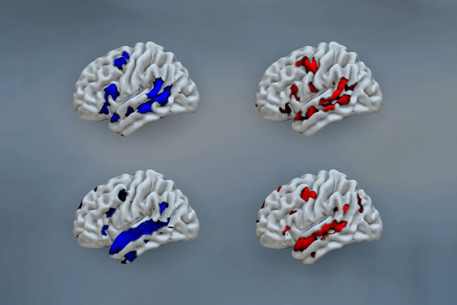 Four 3D brain models show regions of activity highlighted in blue and red.