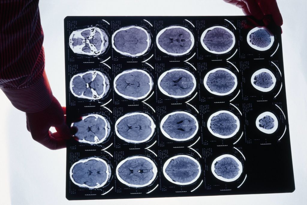 Plate of a radiology computed tomography