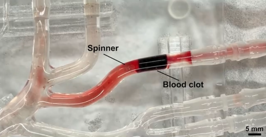 2.5 mm spinner debulks a large blood clot in a blood vessel phantom