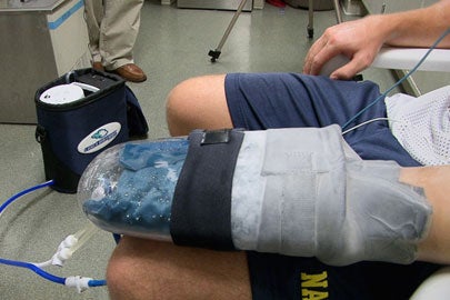 Stanford researchers' cooling glove 'better than steroids'