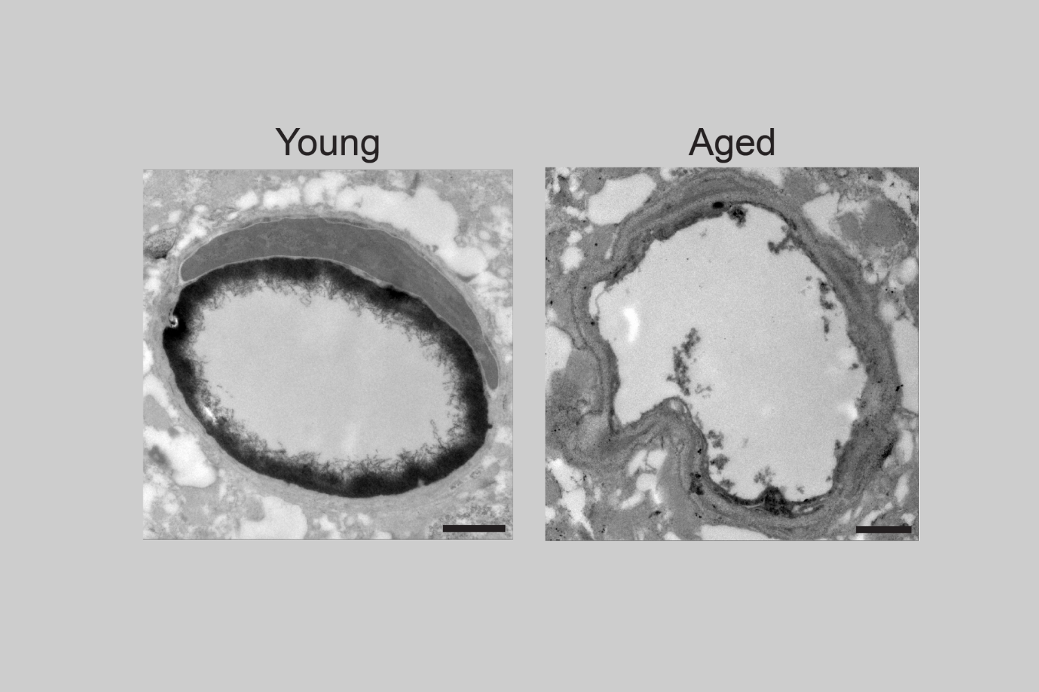 A scientific image comparing sugar molecules in the brain of younger and older mice.