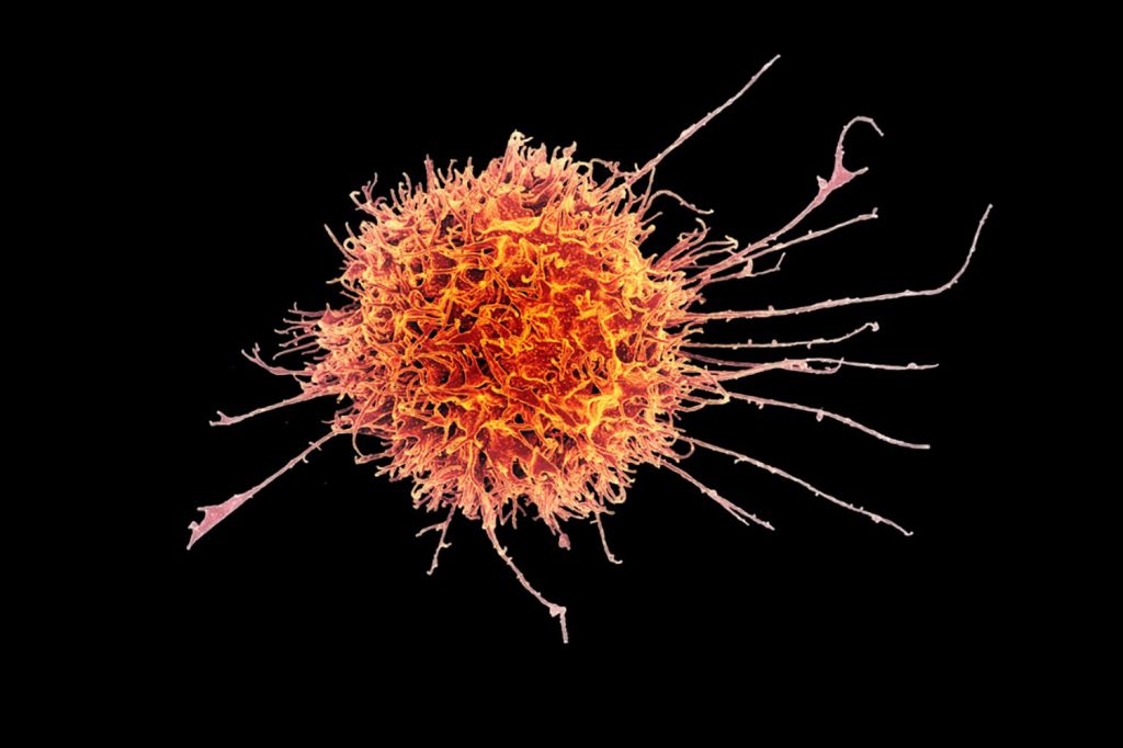 Colorful microscopic image of a natural killer cell against a black background.