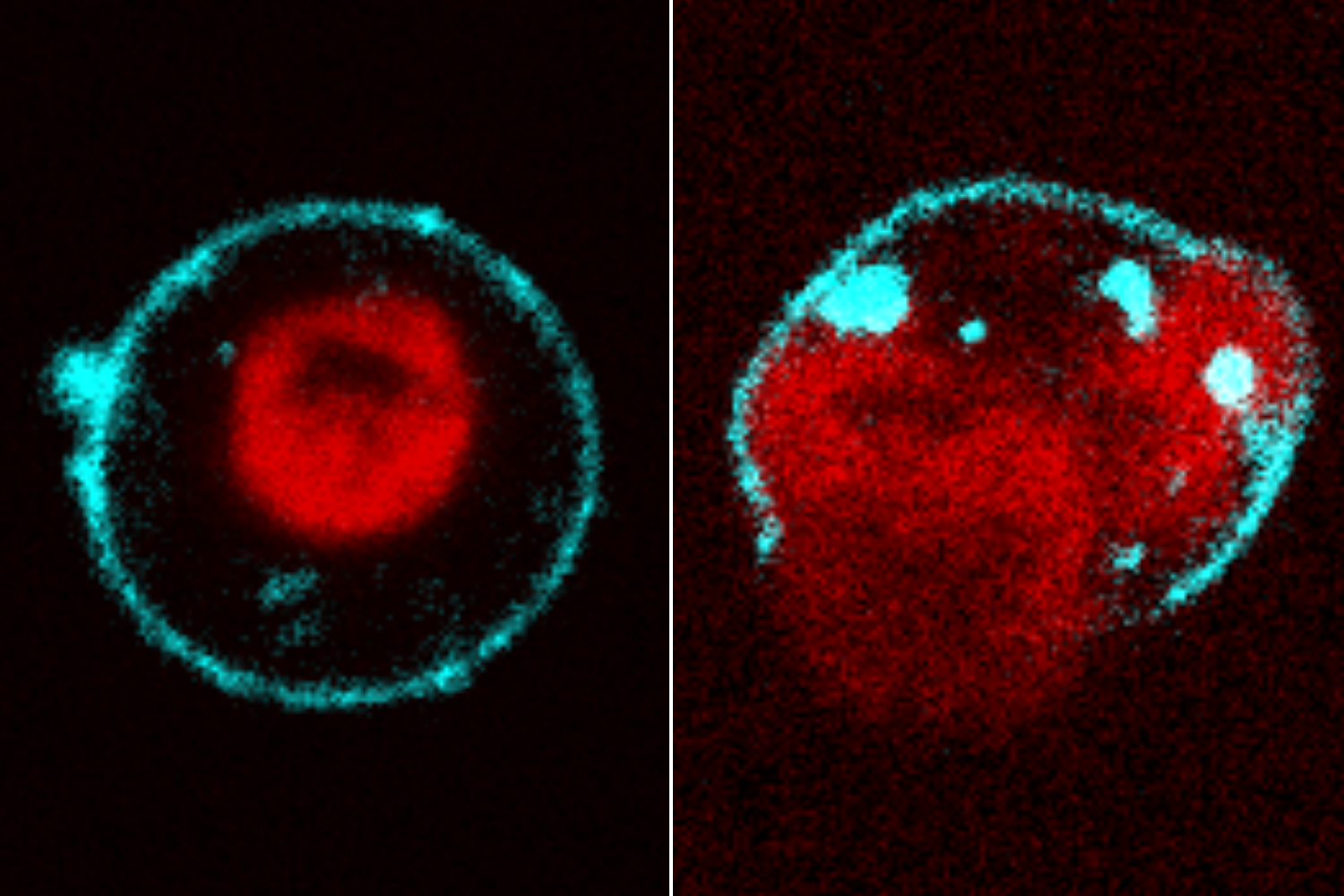 Two immune cells under fluorescence: chromatin sits compact in an intact cell's nucleus (left), then spreads as the membrane ruptures (right).