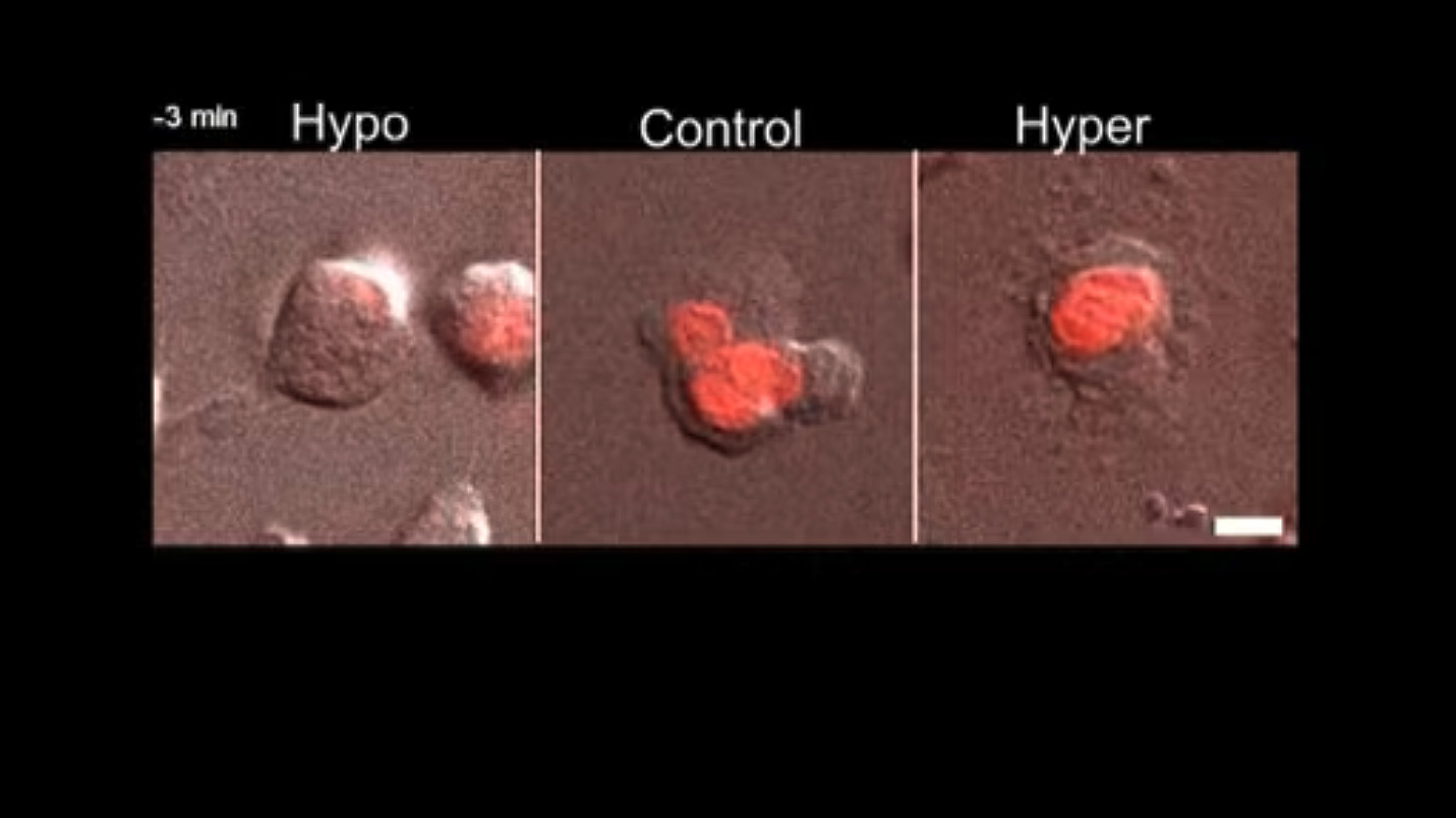 Microscope frames at −3 minutes: cells with red-stained DNA in hypotonic, control and hypertonic solutions; the hypotonic cells look swollen.
