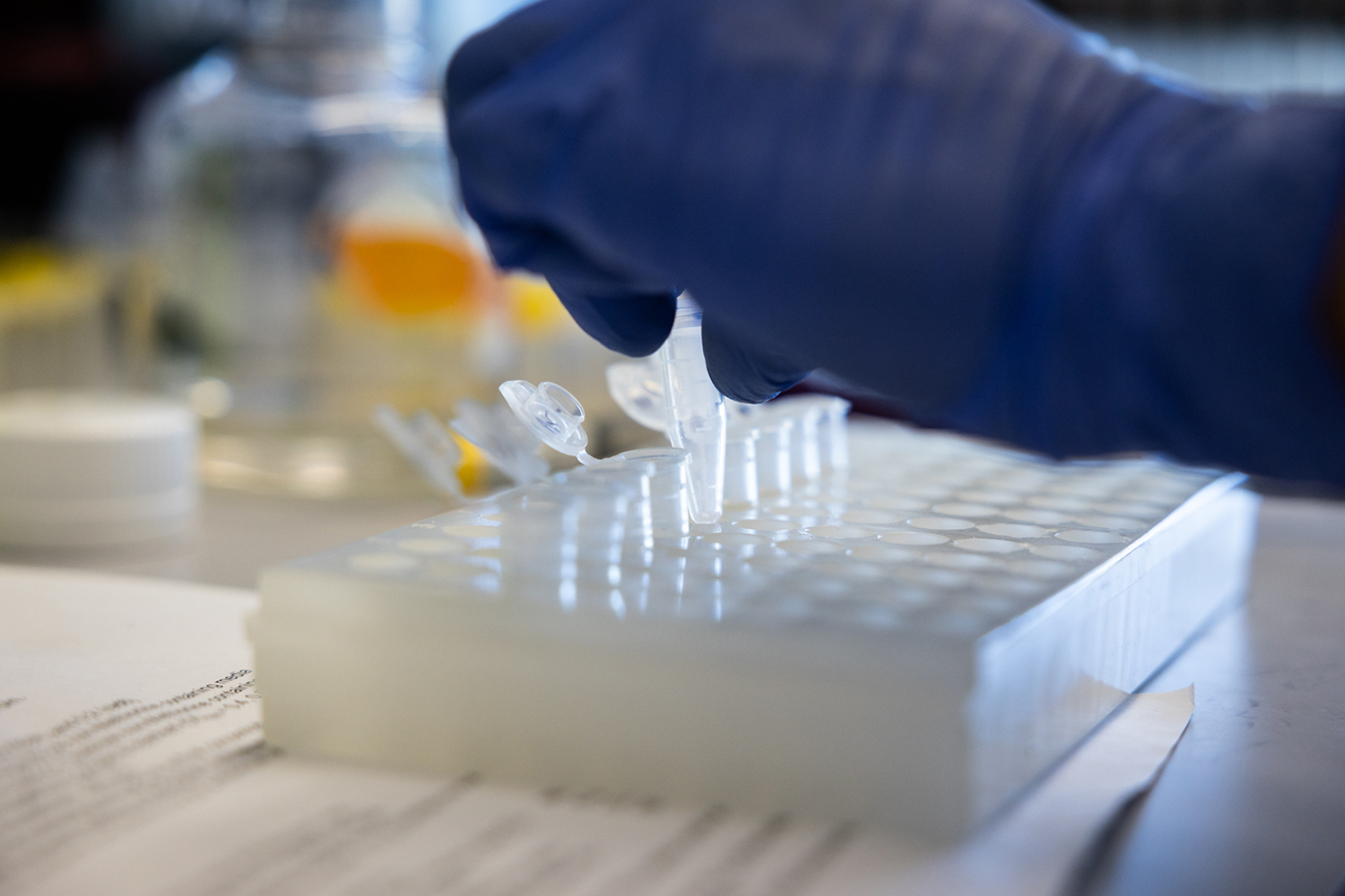 Closeup of a rack of pipettes in a lab