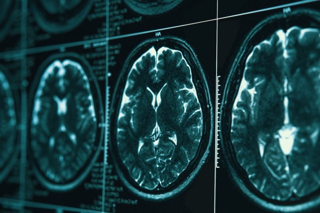 Brain scans
