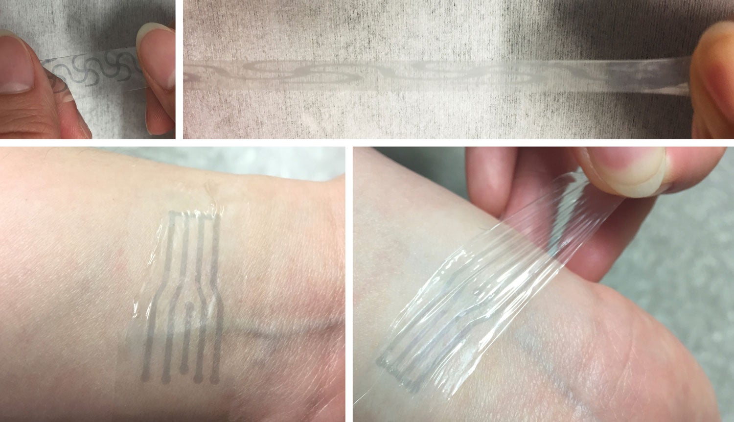 A printed electrode pattern of the new polymer being stretched to several times of its original length (top), and a transparent, highly stretchy “electronic skin” patch forming an intimate interface with the human skin to potentially measure various biomarkers (bottom).