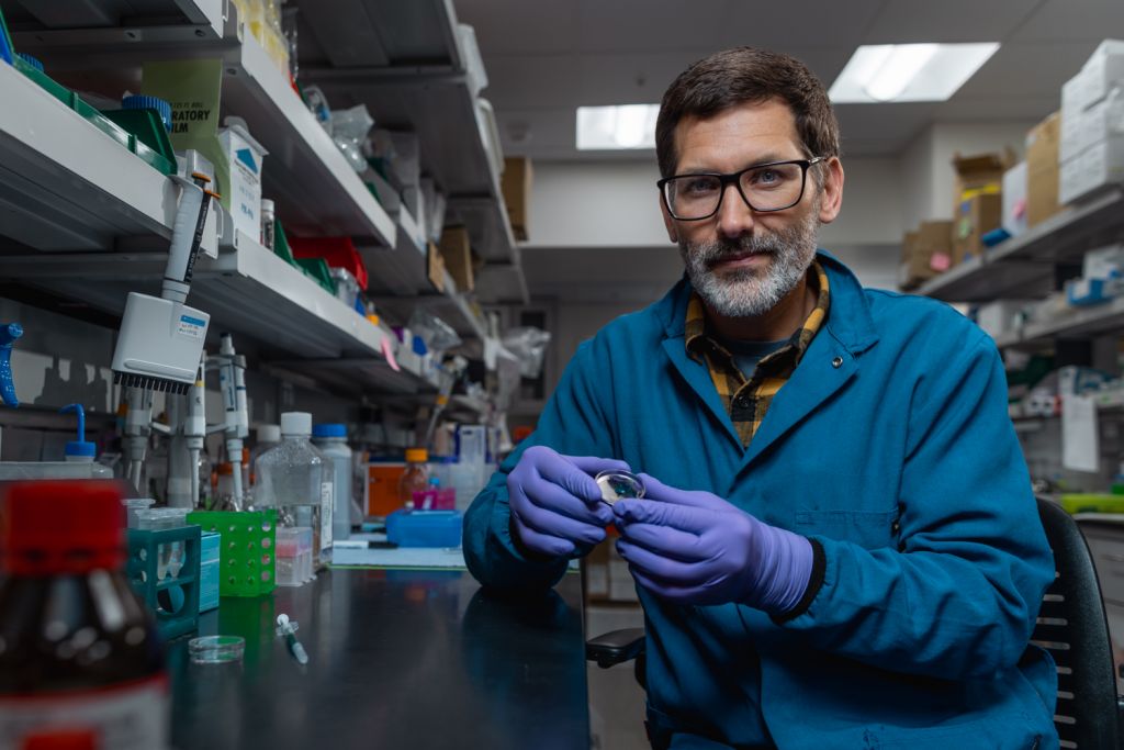 Eric Appel holding a petri dish with the injectable gel that can hold onto drugs and deliver them as they dissolve away over time.