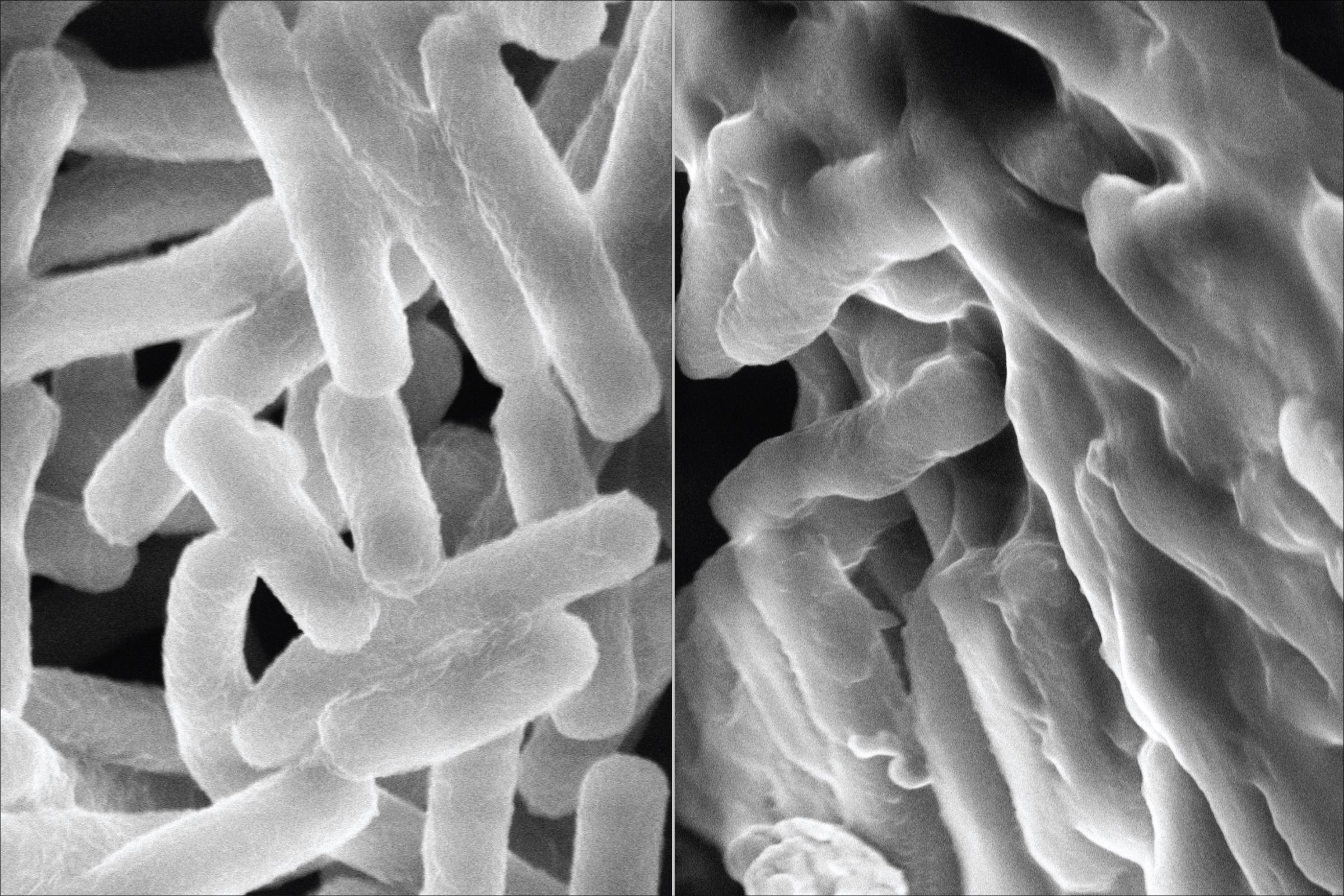 Left: Unperturbed bacteria. Right: Bacteria exhibiting damaged cell membranes after treatment with an antimicrobial polymer.