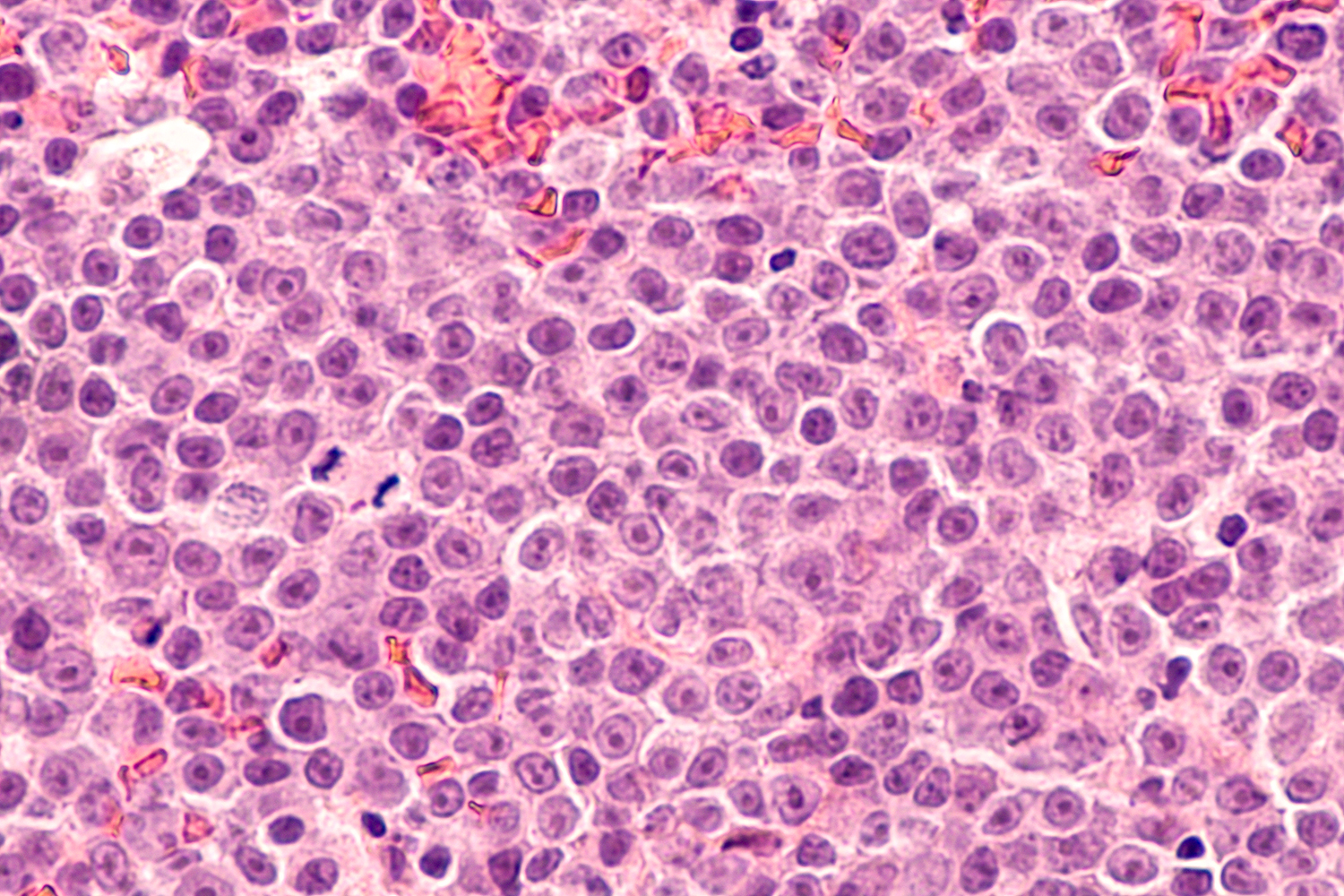 Microscopic view of clustered cells with a pink-purple hue.