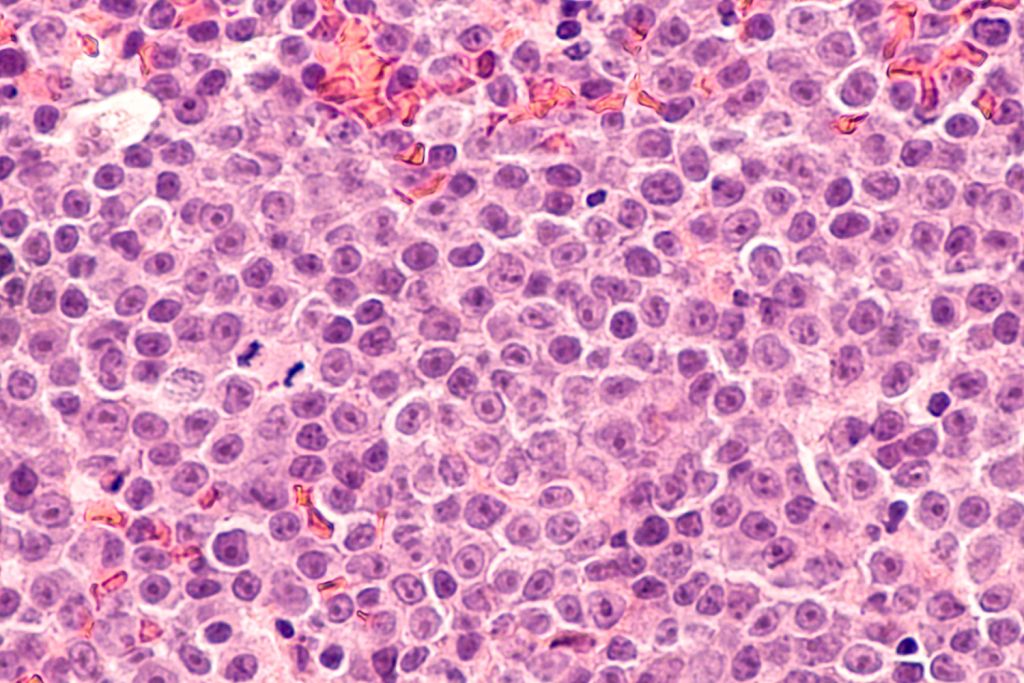 Microscopic view of clustered cells with a pink-purple hue.