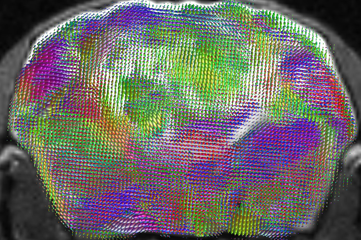Coronal MRI of a mouse brain overlaid with multicolored diffusion tensor ellipsoids mapping white-matter fiber orientations.