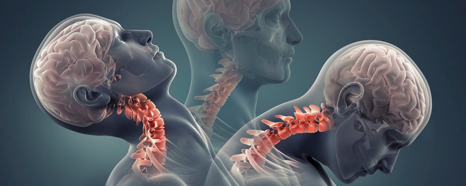 man x-ray with neck bones highlighted