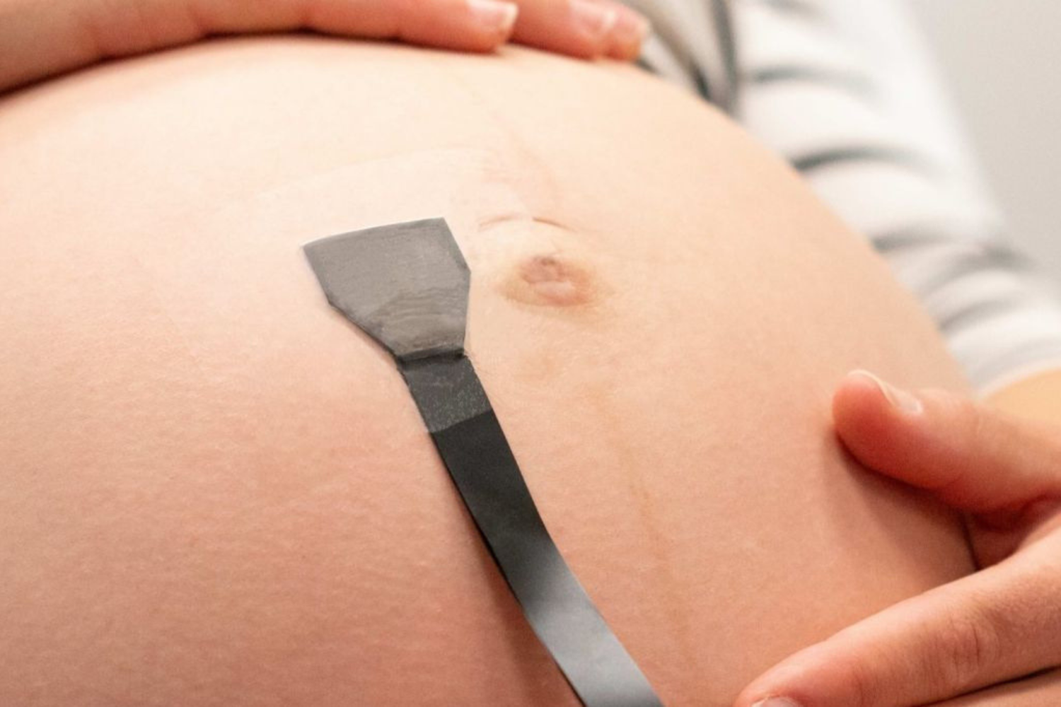 A hand rests on a pregnant belly where a black ultrasound probe is placed for monitoring.