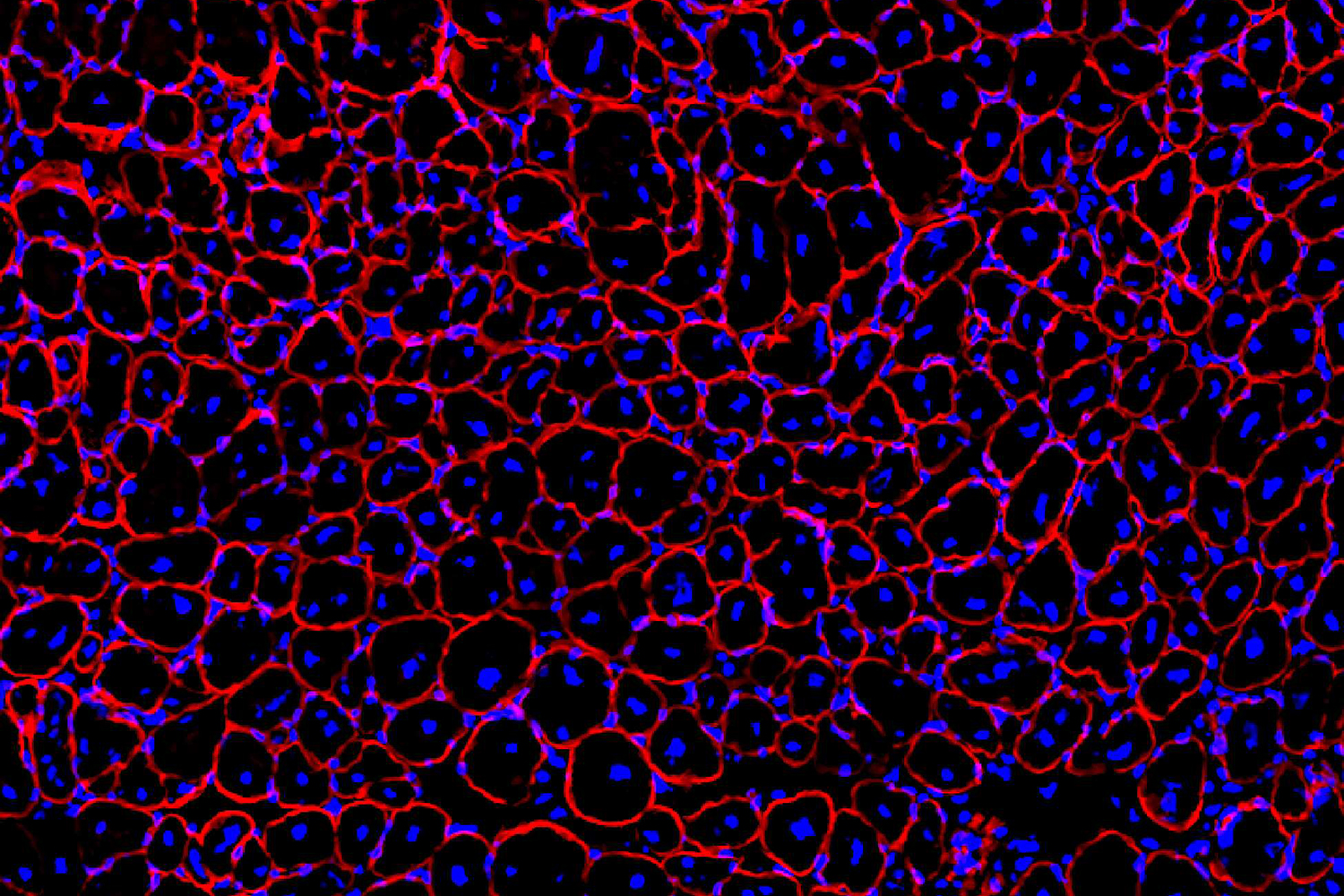 GLP-1治療患者の筋肉回復に希望を示す研究（Research Offers Hope for Muscle Recovery in GLP-1 Patients）