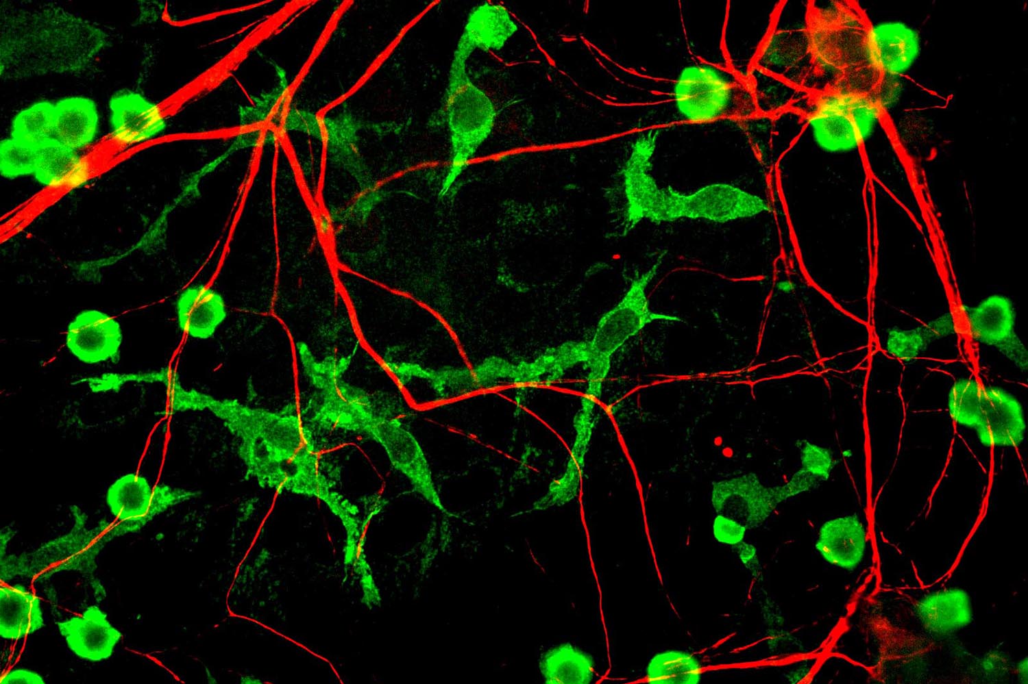 Rendering of lipid droplets in microglia.