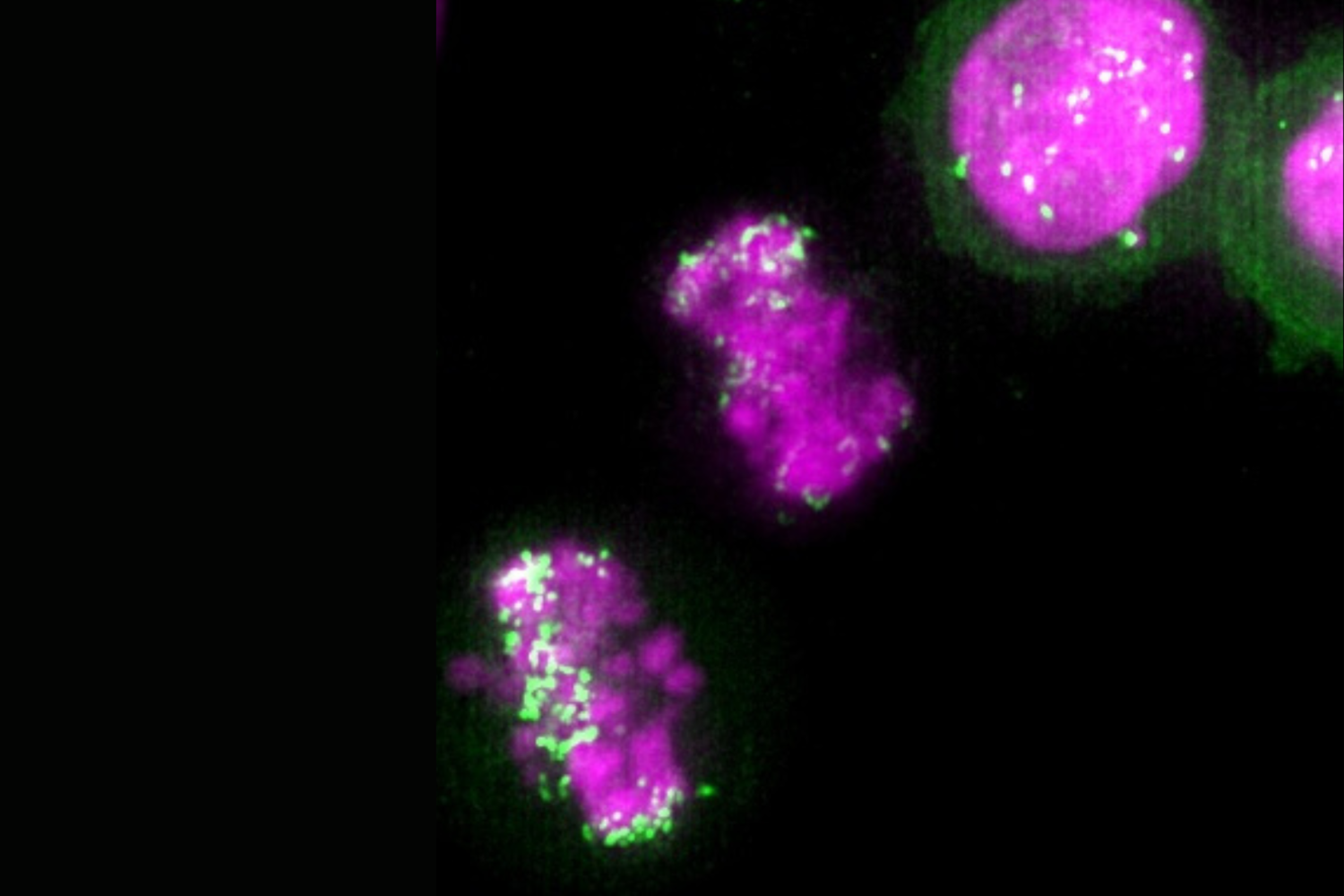 Image of a colon cancer cell with ecDNA undergoing cell divison.
