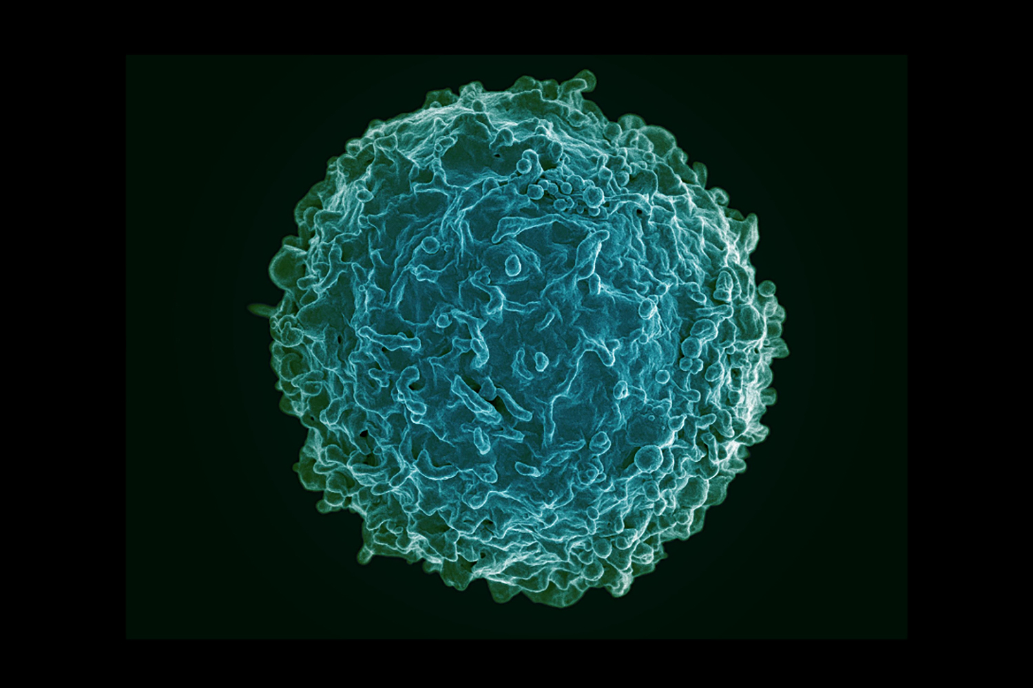 A scanned image of a B cell displayed against a dark background.