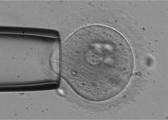 pipette and embryo