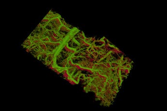 image of blood vessels in a mouse ear