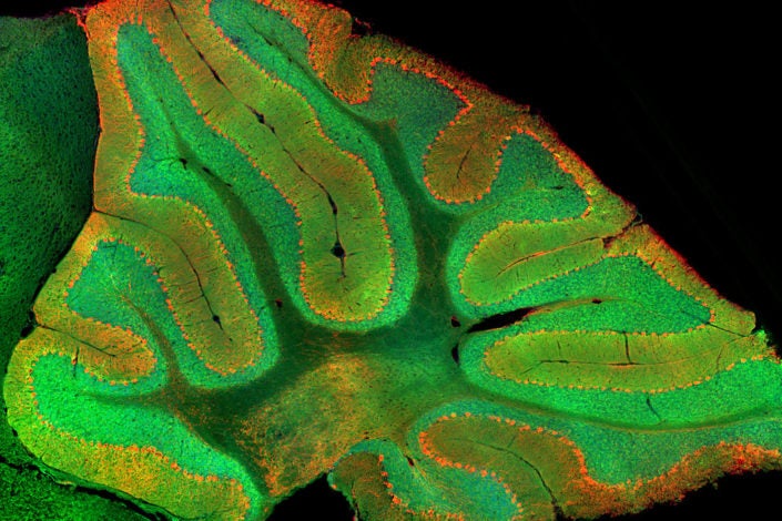 Image showing granule cells in the cerebellum