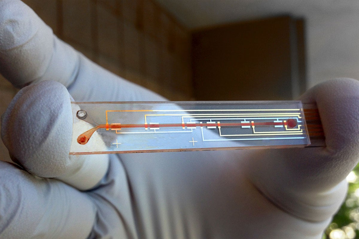 prototype of a biosensor designed to detect active levels of a medicine in the bloodstream