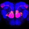 Drosophila brain with various olfactory neurons labeled by different-colored fluorescent markers
