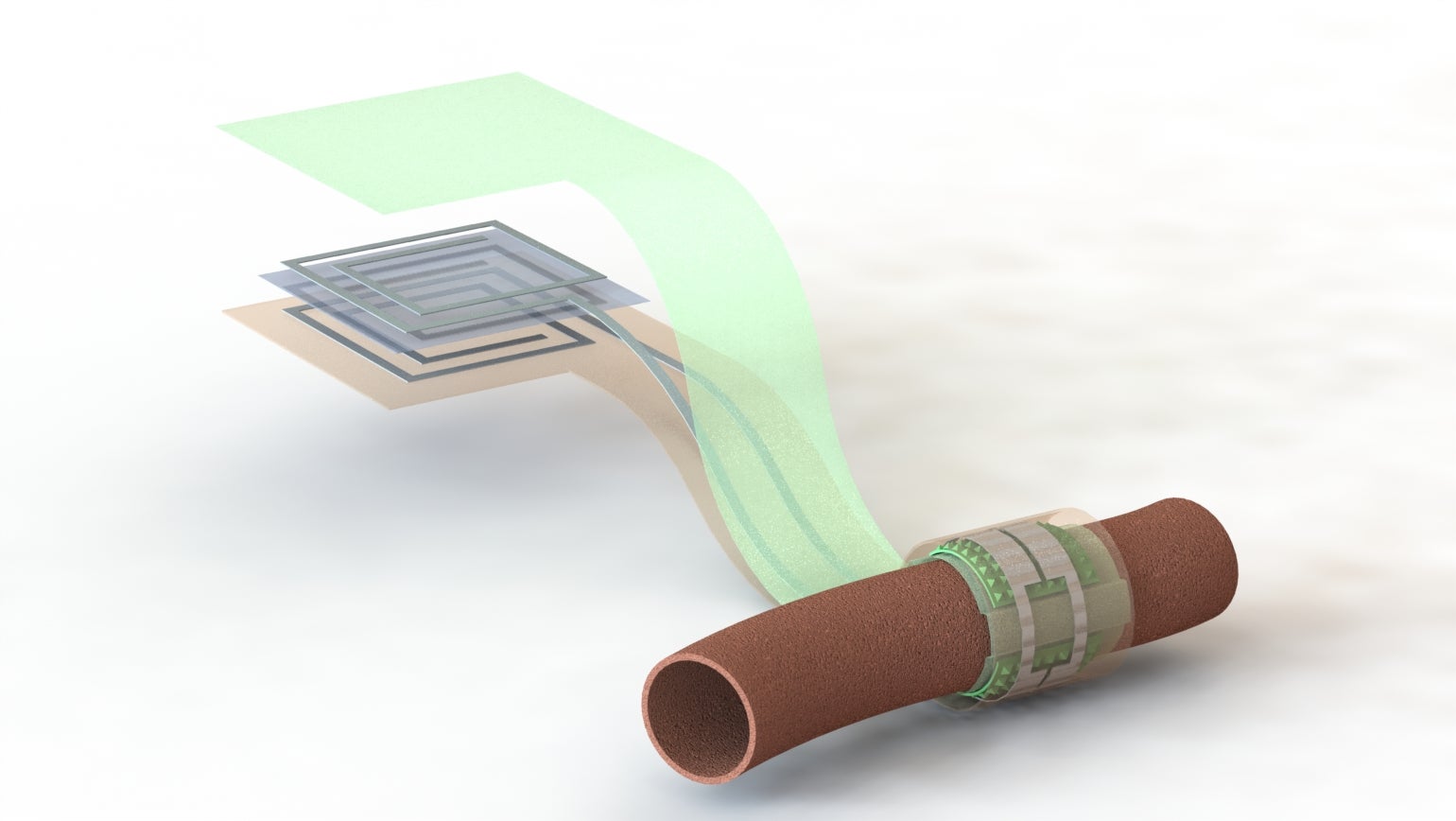 Artist’s depiction of the biodegradable pressure sensor wrapped around a blood vessel with the antenna off to the side (layers separated to show details of the antenna’s structure).
