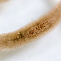 Flatworm under microscope