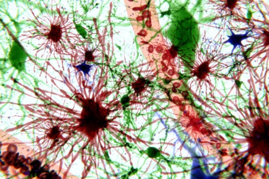 Brain cells with the focus put on astrocytes - stock photo Neurons (green), astrocytes (red), glia cells (blue)